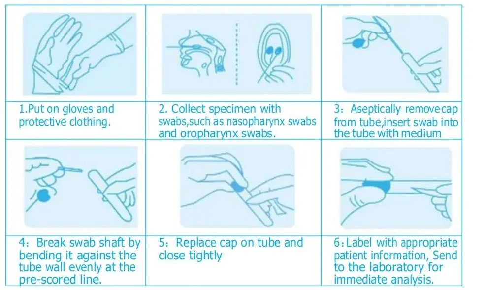 Medical Consumables Non-Inactivated Vtm with 3ml Storage Solution