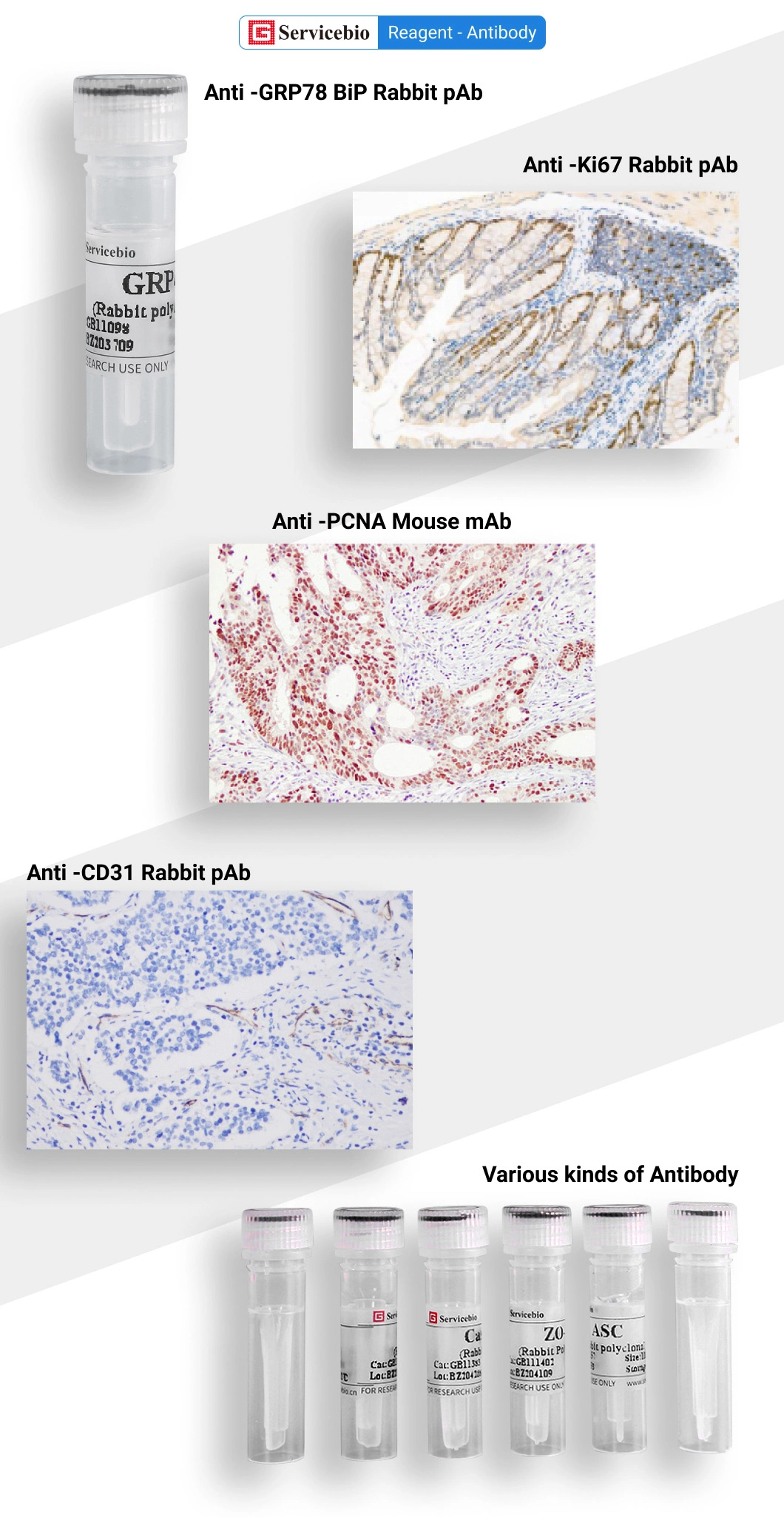 Recombinant Mouse Mab Alpha Tubulin Antibody