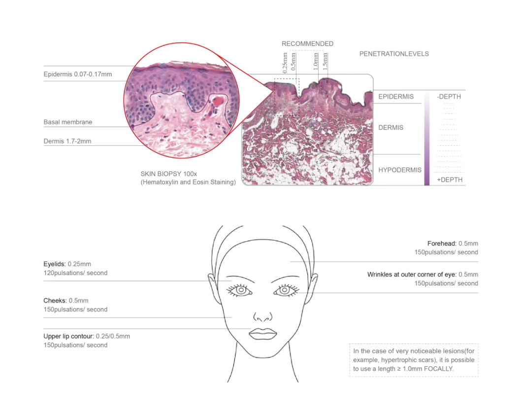 Nano Microneedle Dermapen with Replaceable Needle Cartridge