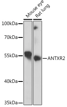Anticorpo Policlonal Antxr2